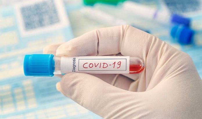 Kanaru salose Covid-19 naujienos: 100 nauju susirgimu, antra diena is eiles neuzfiksuoti mirties nuo koronaviruso atvejai